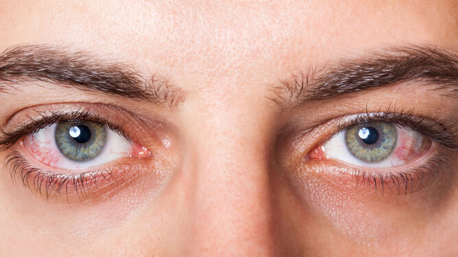 Las pupilas grandes son un síntoma de inteligencia