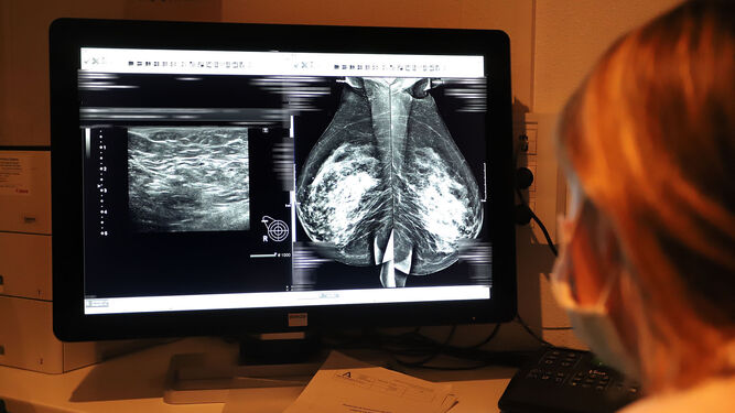 Imagen de archivo de una mamografía en el hospital Juan Ramón Jiménez.