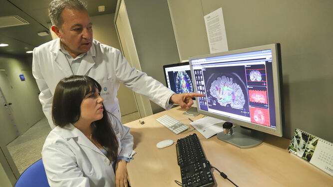Dos médicos observan la imagen de un cerebro.